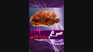 صحبت های دکتر علیرضا یار احمدی در مورد صرع و روزه داری