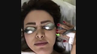 اجاره لیزر الکساندرایت