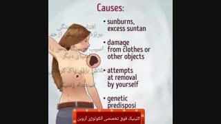 تبدیل خال به سرطان
