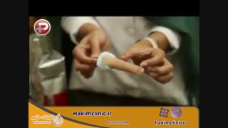 ویدیویی از مراحل ساخت پروتز زیبایی انگشت در ایران