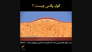 بهترین روش از بین بردن چربی بدون جراحی