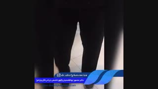 بعد از تعویض مفصل زانوی چپ