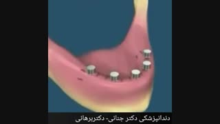 دندان های خود را از دست ندهید!!!