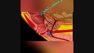نحوه معاینه پروستات در آقایان | دکتر محمد رنجبری