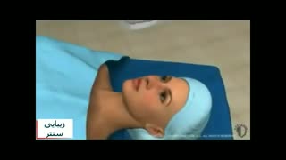 جراحی بینی یا رینوپلاستی - عمل بینی گوشتی و استخوانی - زیبایی سنتر