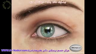 درمان گل مژه - مرکز چشم پزشکی دکتر علیرضا نادری
