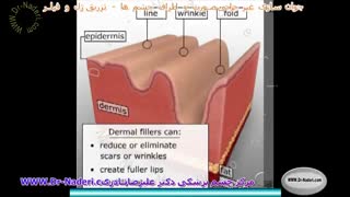تزریق ژل و فیلر - مرکز چشم پزشکی دکتر علیرضا نادری منافذ باز پوست