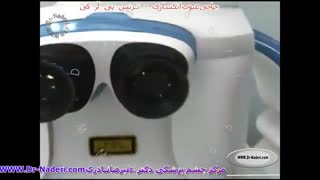 ترانس پی آر کی Trans PRK - مرکز چشم پزشکی دکتر علیرضا نادری