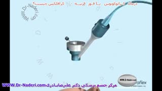 کرافلکس - مرکز چشم پزشکی دکتر علیرضا نادری