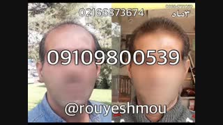 تاثیر محلول لاناریا