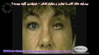 هیدروکسی آپاتیت چیست؟ مرکزچشم پزشکی دکتر علیرضا نادری