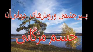 جسم مژگانی چشم - مرکزچشم پزشکی دکتر علیرضا نادری