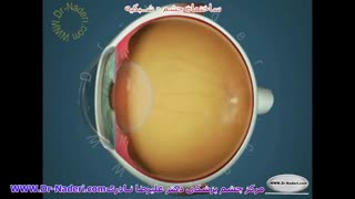شبکیه -ساختمان چشم-مرکز چشم پزشکی دکتر علیرضا نادری