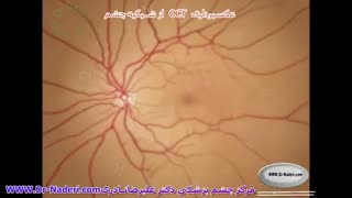 تصویربرداری اپتیکی شبکیهOCT  - مرکز چشم پزشکی دکتر علیرضا نادری