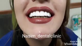 دندانپزشکی نسیم قیطریه-ونیرکامپوزیت-لمینت-ارتودنسی-ایمپلنت