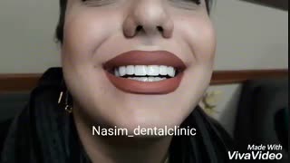 دندانپزشکی نسیم قیطریه-درمانگاه نسیم قیطریه-لمینت –کامپوزیت-ونیر-ارتودنسی-ایمپلنت-کاشت دندان