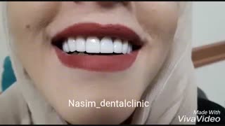 دندانپزشکی نسیم قیطریه-درمانگاه نسیم قیطریه-لمینت –کامپوزیت-ونیر-ارتودنسی-ایمپلنت-کاشت دندان