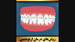 ارتودنتیست تهران | دکتر داودیان