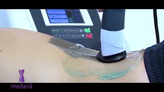 زیبایی و تناسب اندام با دستگاه امپریومد 400