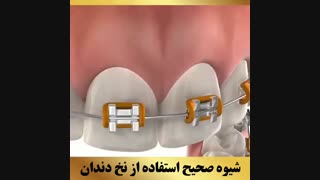 ارتودنسی تهران | دکتر داوودیان