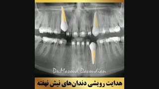 دکتر ارتودنسی | دکتر داوودیان
