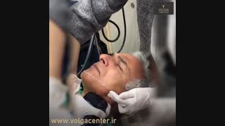 لیفت صورت بدون جراحی به وسیله هایفوتراپی