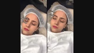 آبرسانی پوست (هیدرادرمی) و ماساژ صورت