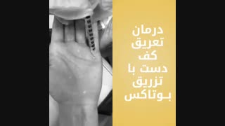 فیلم درمان تعریق کف دست 0