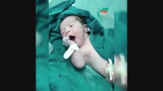 تولد نوزاد