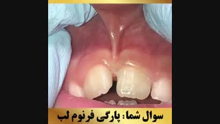 متخصص ارتودنسی | دکتر داودیان