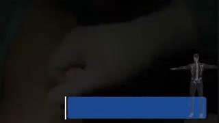 برداشت گرافت تاندون و کارگذاری آن