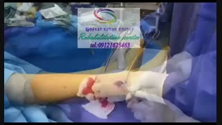 مراکز تخصصی کاردرمانی پا بعد از جراحی در کرج|گفتار توان گستر البرز09121623463