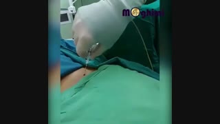 فیلم جراحی دیسک کمر با لیزر