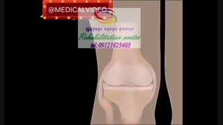بهترین مراکز کاردرمانی در شرق کرج|گفتار توان گستر البرز09121623463