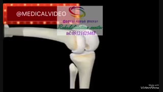 برترین مراکز کاردرمانی بعد از جراحی در کرج،کاردرمانی چیست؟ (بررسی تخصصی کاردرمانی)|گفتارتوان گستر البرز09121623463