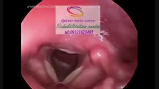 تخصصی ترین مراکز گفتاردرمانی البرز|گفتار توان گستر البرز09121623463