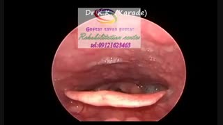 مرکز تخصصی گفتاردرمانی جنوب کرج|گفتار توان گستر البرز09121623463