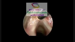 تخصصی ترین مراکز گفتار درمانی در غروب کرج|گفتارتوان گستر البرز09121623463