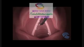کلینیک های فوق تخصصی گفتاردرمانی و درمان حنجره در کرج|گفتار توان گستر البرز09121623463