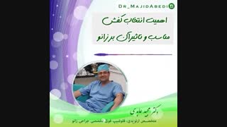 اهمیت انتخاب کفش مناسب و تاثیر آن بر زانو