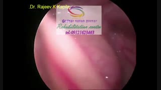 برترین مراکز درمان بیماری های حنجره در کرج|گفتار توان گستر البرز09121623463