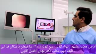 فیلم آندوسکوپی کامل معده توسط دکتر مهدی افضل آقایی