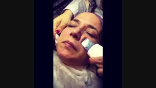 پاکسازی صورت - 22807060