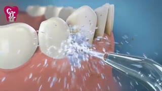 دستگاه واتر فلاسر | کلینیک دندانپزشکی بیمارستان بهمن