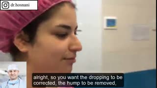 بازگشت به لندن با یک بینی خوشگل و عالی