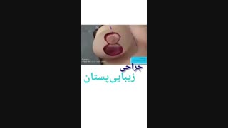 جراحی زیبایی سینه