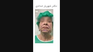 جوانسازی صورت