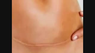 بریدن 7 لایه شکم و ترمیم آن در طی زایمان سزارین