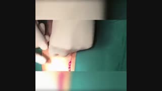 لیپوماتیک - دکتر ابدالی - 22807060