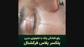 پلکسر پلاس فرکشنال فراتر از یک ابزار
